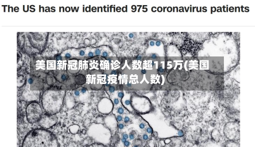 美国新冠肺炎确诊人数超115万(美国新冠疫情总人数)-第2张图片