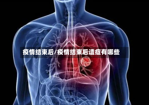疫情结束后/疫情结束后遗症有哪些-第2张图片
