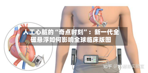 人工心脏的“奇点时刻”：新一代全磁悬浮如何影响全球临床版图